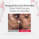 MEDICUBE Hypochlorous Acid Daily Facial Spray